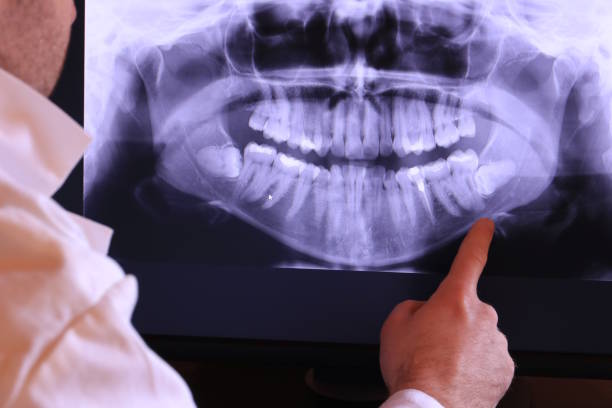 Best After-Hours Emergency Dentist in St Matthews, KY